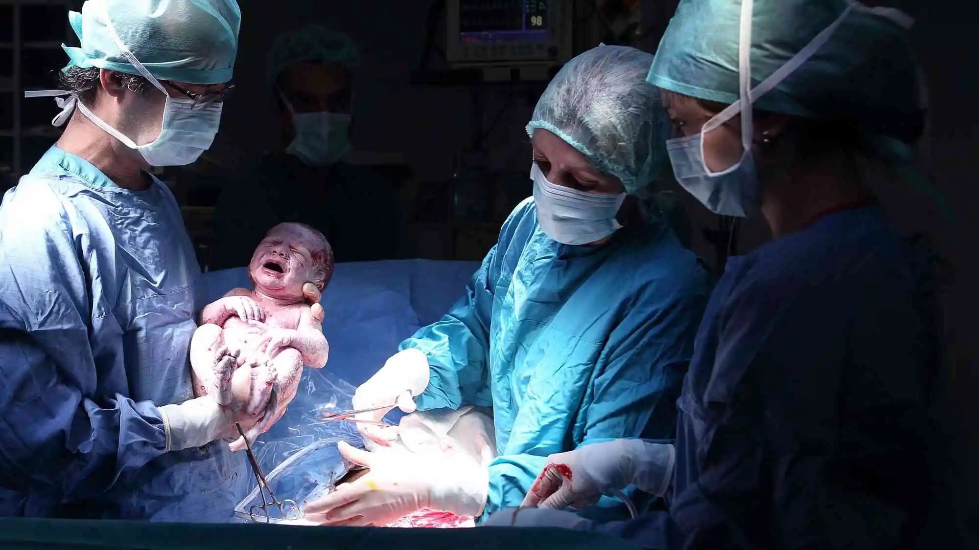 What-is-the-cost-Cesarean-Delivery-_C-Section_-Cost-in-India