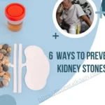 6 Ways to Prevent Kidney Stones fitnesstalkdaily