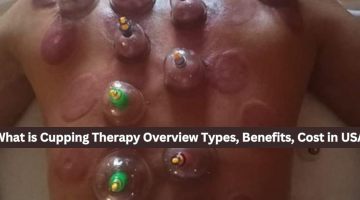 Cupping therapy cost usa