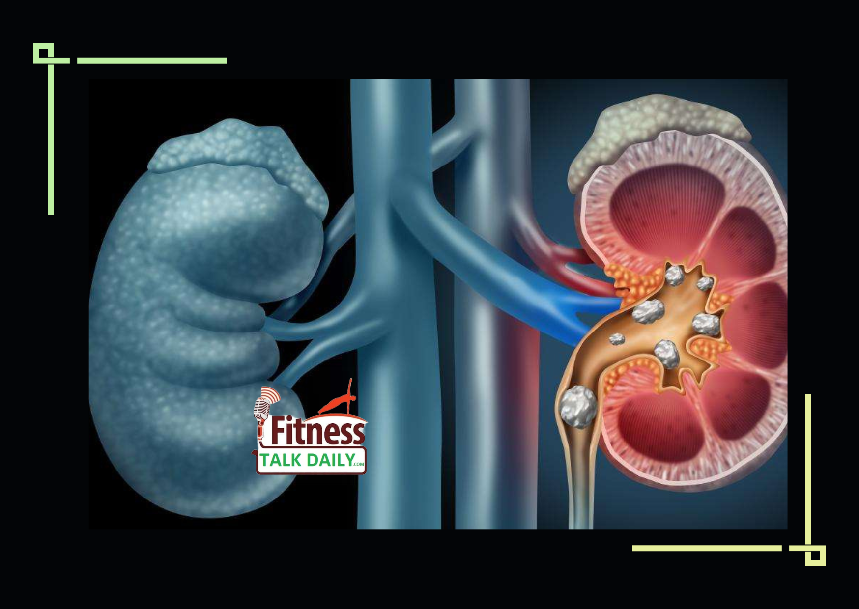 5 Unusual Kidney Damage Symptoms