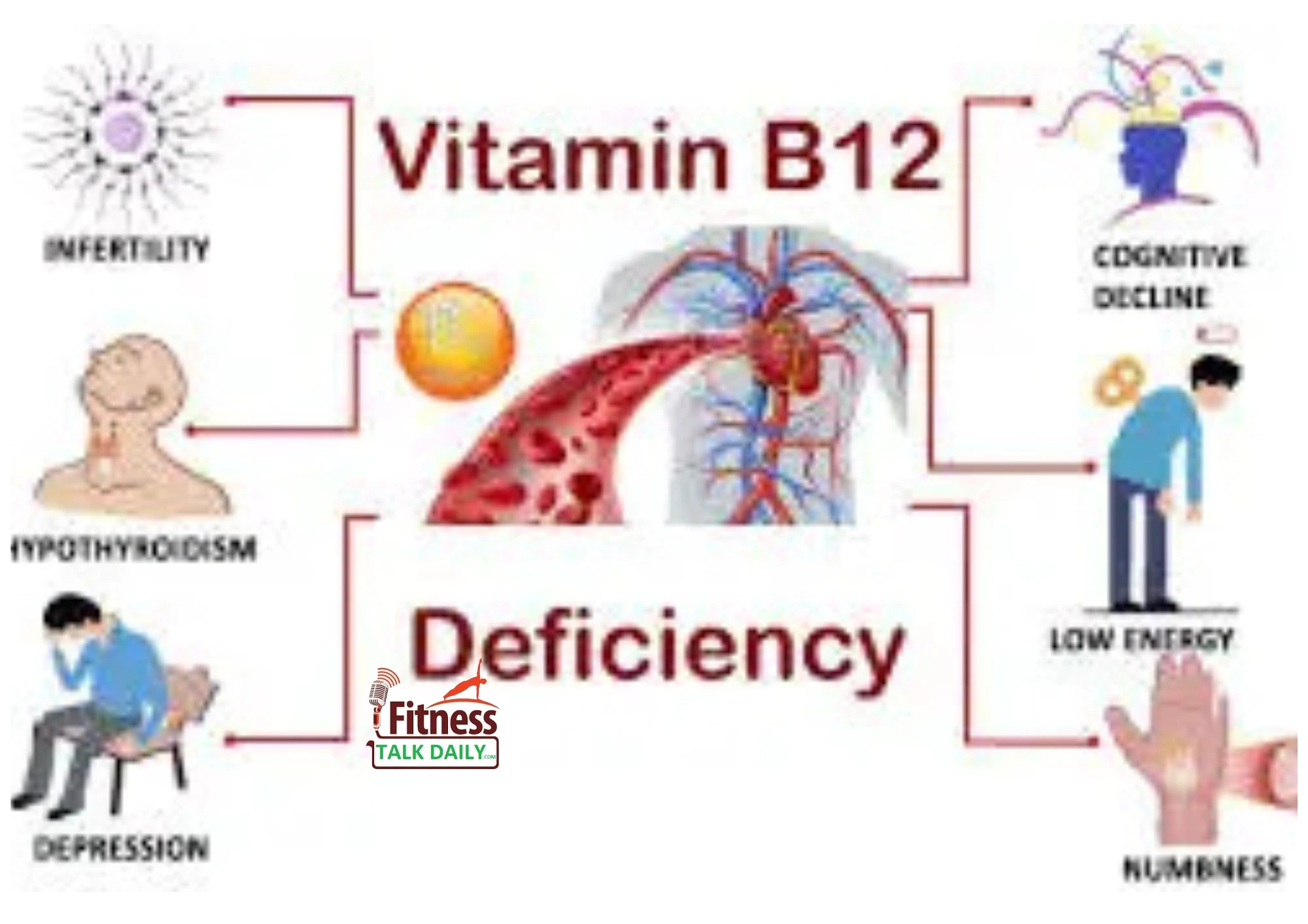 Vitamin B12 Deficiency: