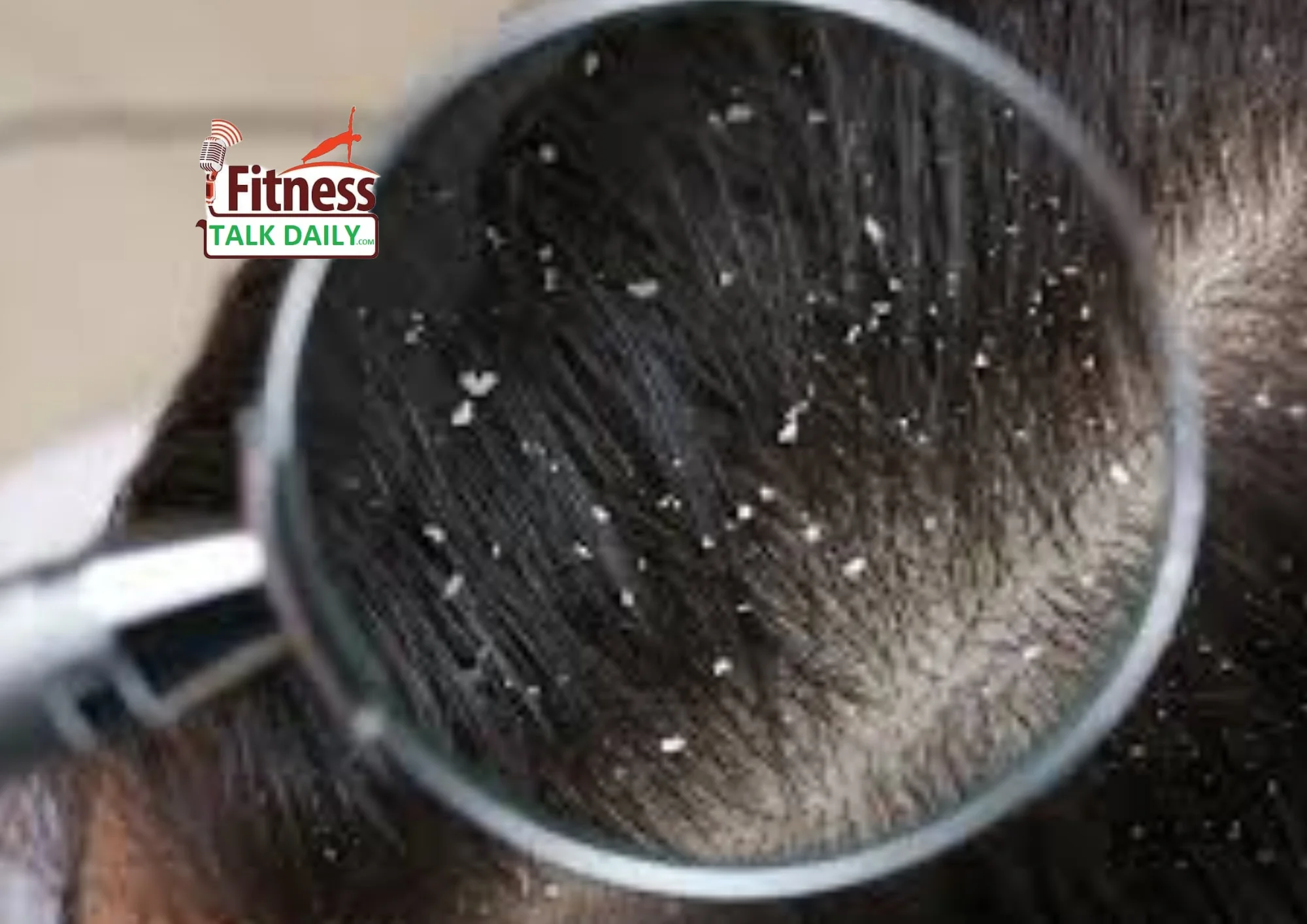 Hair Fall to Dandruff